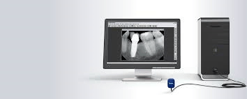 Monitor showing x-ray of teeth